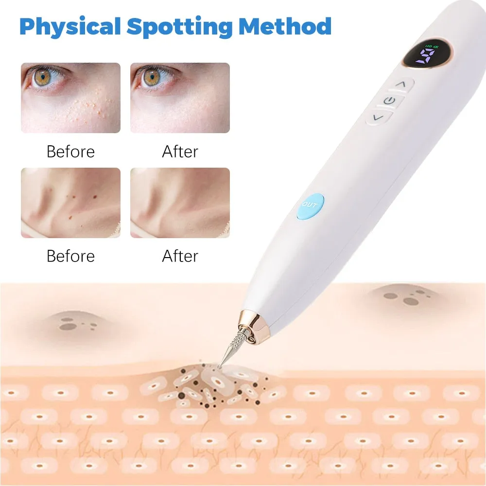 9 Mode Laser Plasma Pen Freckle Remover Mole Dark Spot Black Dot Skin Tag Wart Removal Facial Clean